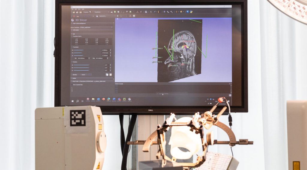 Bild eines Gehirn-Scans auf einem Monitor, medizinische Geräte im Vordergrund.