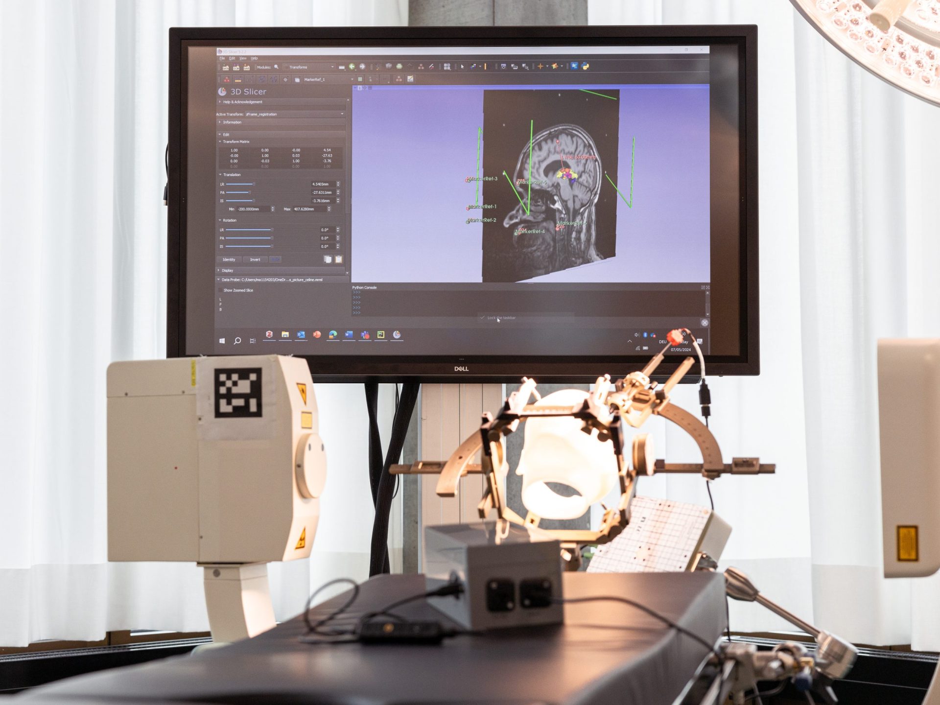 Bild eines Gehirn-Scans auf einem Monitor, medizinische Geräte im Vordergrund.