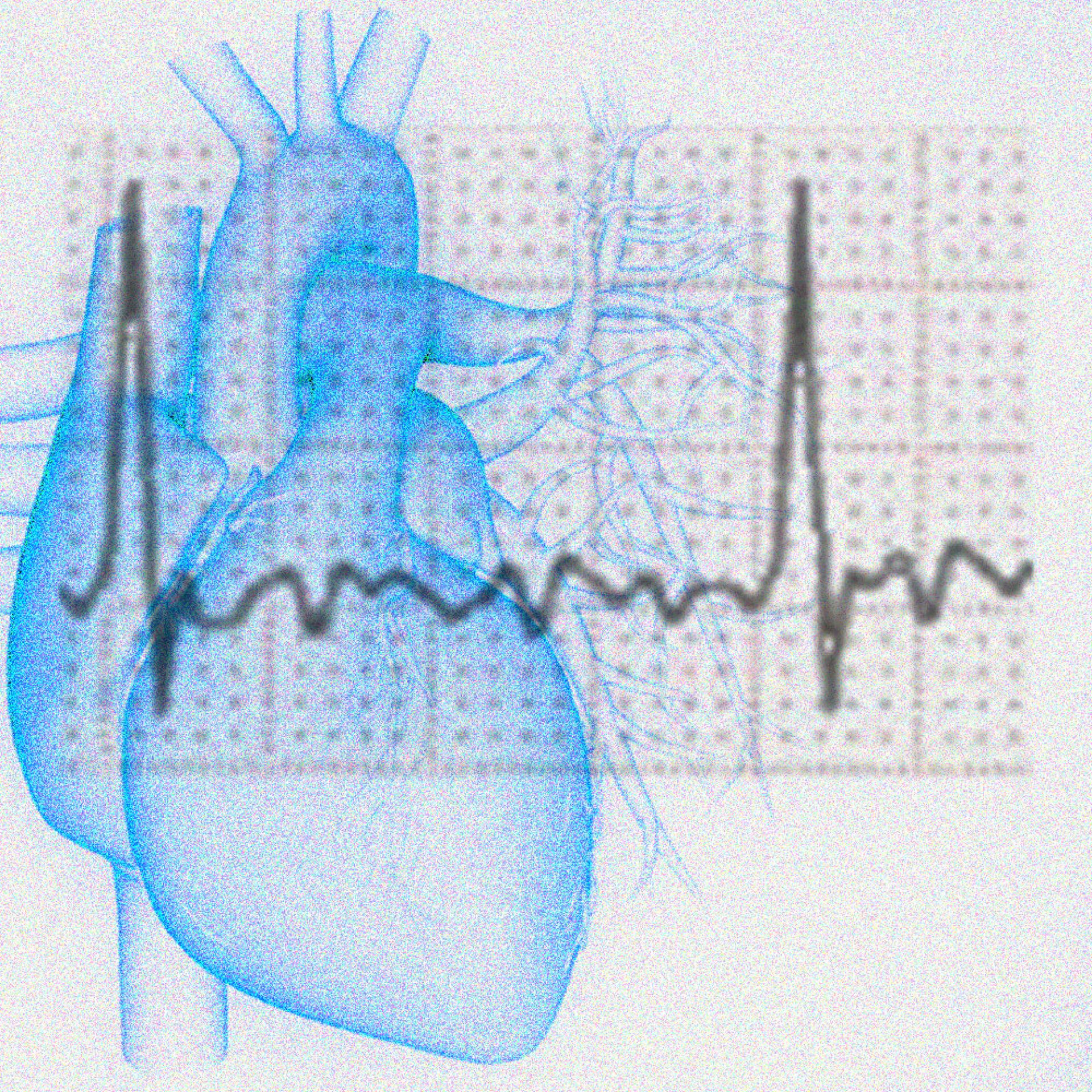 Bildmontage einer Zeichnung eines menschlichen Herz im Hintergrund und davor der Graph eines EKG